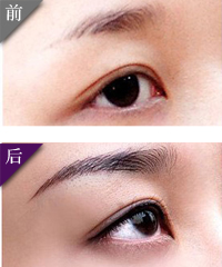 切眉提眉案例对比图