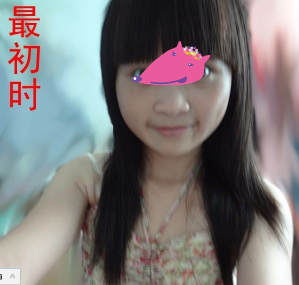 补牙