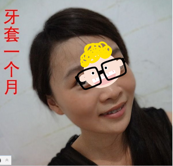 补牙