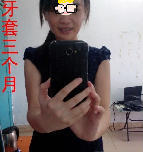 补牙