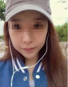 术后