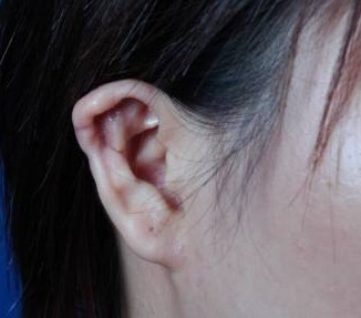 菜花耳