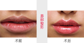 纹唇