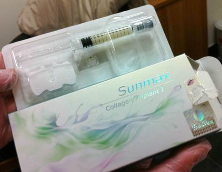隆鼻和隆下巴用的双美胶原蛋白