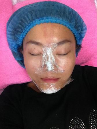 隆鼻和隆下巴前敷麻药