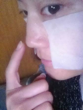WENDY0216隆鼻后的侧面照