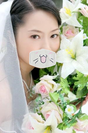 祛眼袋的真实案例