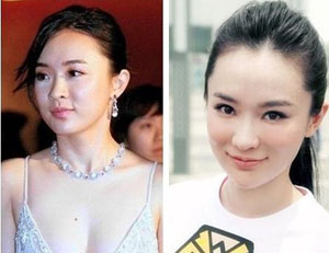 霍思燕整容前后对比图