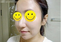 术后