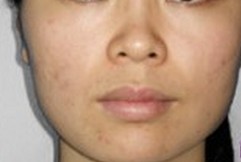 大S美白针 打造现实“白雪公主”