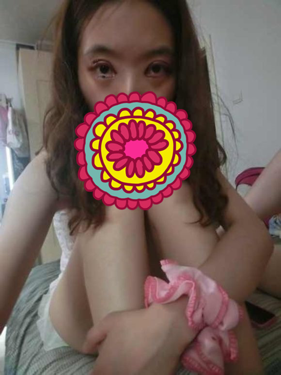 双眼皮手术的案例