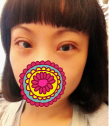 手术恢复过程