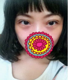手术后