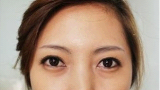 术后