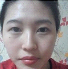 术前