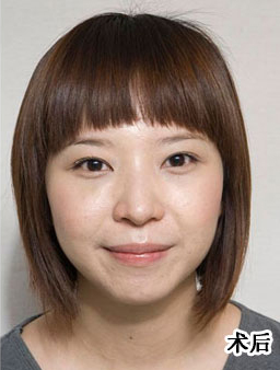 去眼袋
