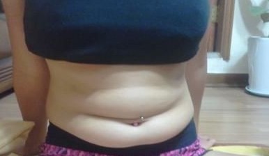 吸脂手术