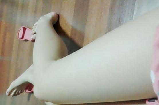 激光脱毛