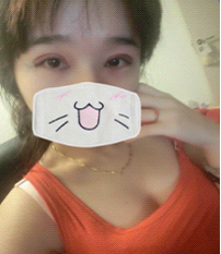 术后