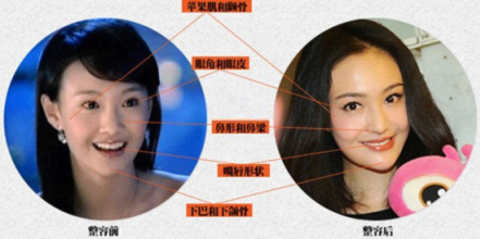 郑爽整容对比照