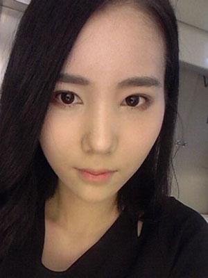 术后