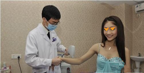 激光祛斑的案例